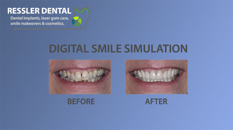 delray beach dentist before and after
